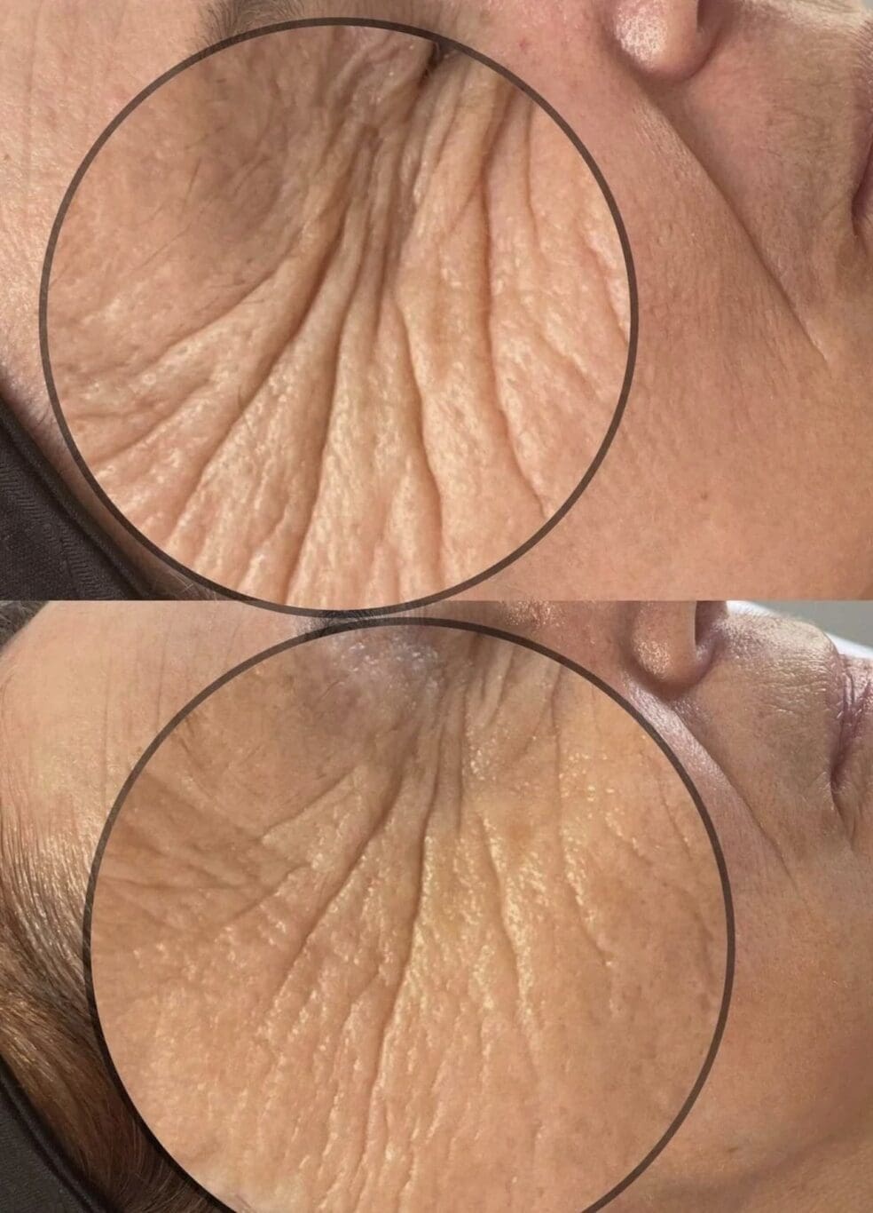 glass skin treatment 2