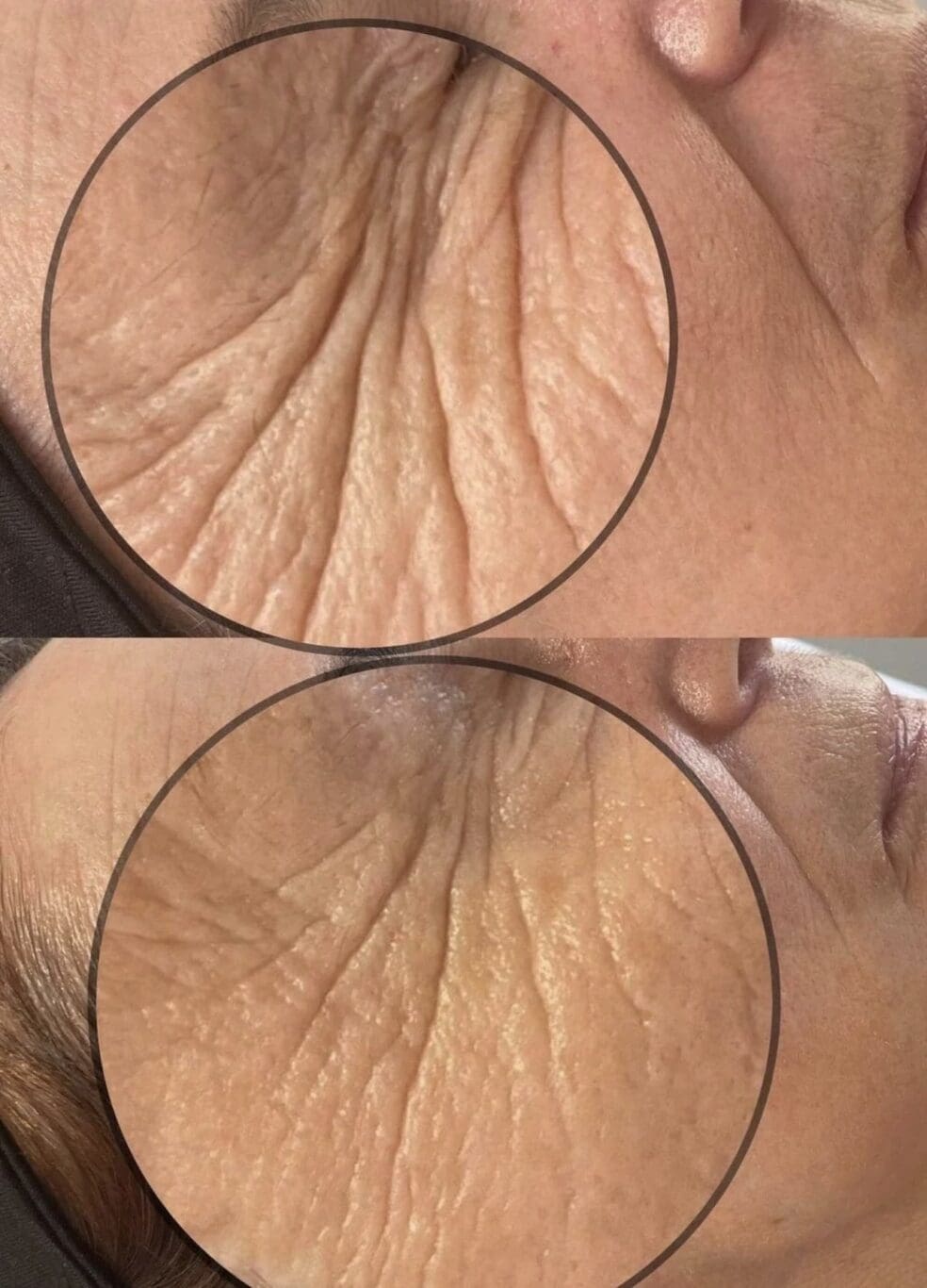 glass skin treatment 2